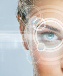 chirurgie refractive