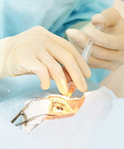 injection intra vitreenne