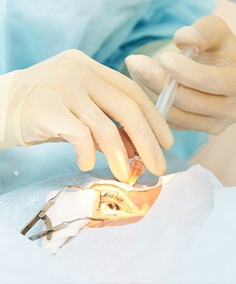 injection intra vitreenne