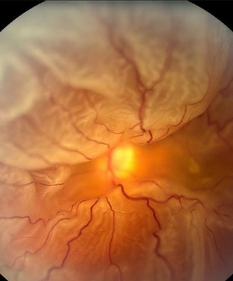 image article