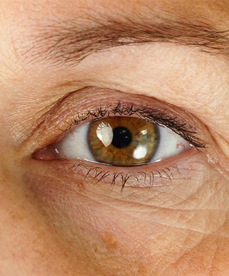 image article