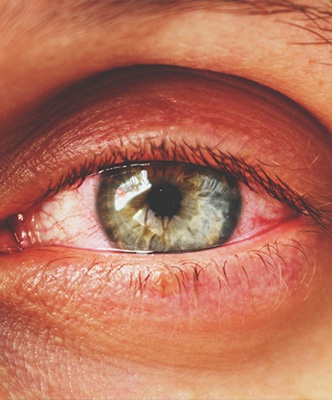 image article