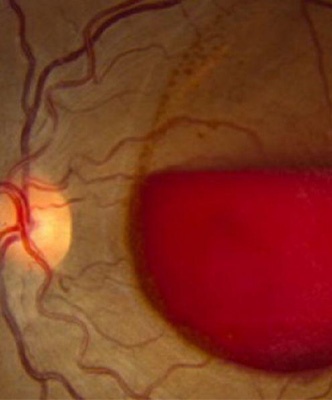 image article
