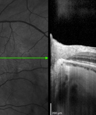 image article